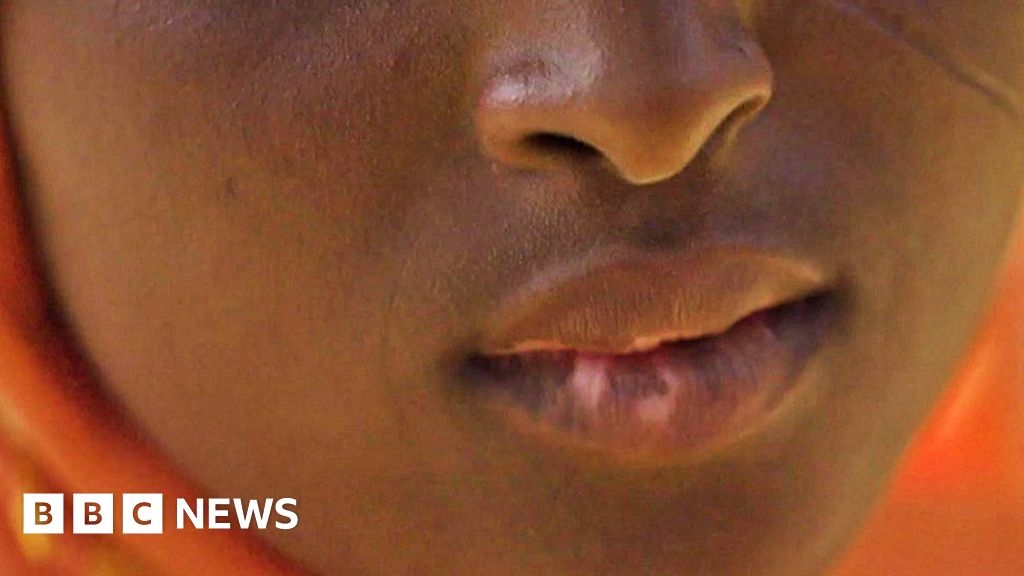 Skin-lightening creams in Nigeria: 'I scarred my six children'