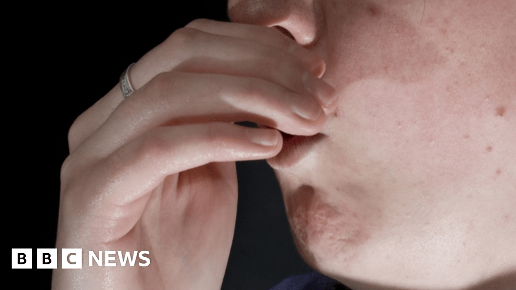 North Cumbria and North East highest for repeat lung admissions