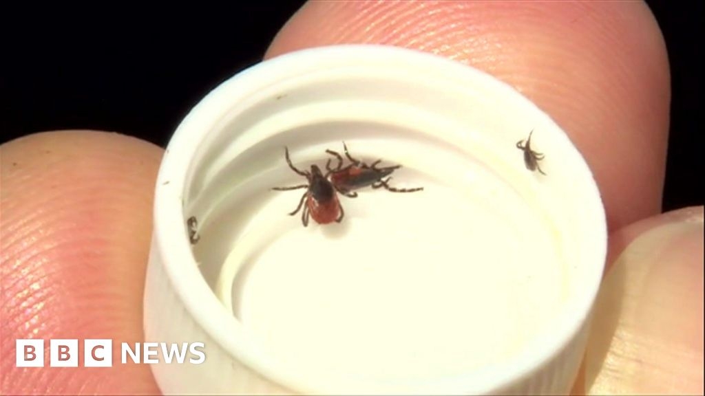 Islanders warned of Jersey's tick 'hotspots'