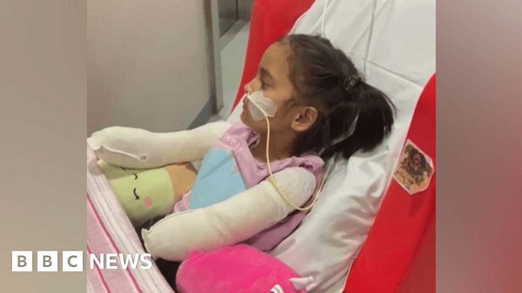 Stockton girl's meningitis leads to quadruple amputation
