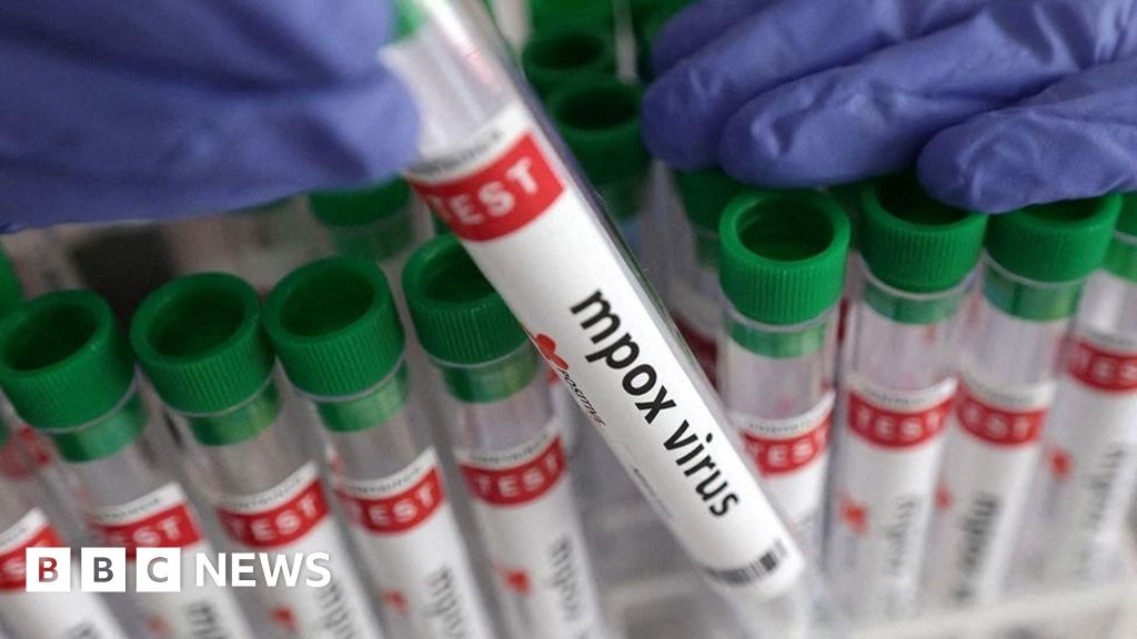 Mpox: Ireland records first case of Clade 1 variant