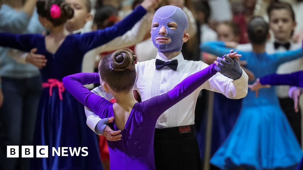 Boy burned in Ukraine air strike inspires ballroom film