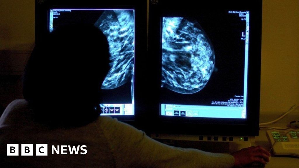 Calls for transgender and non-binary people to get mammograms