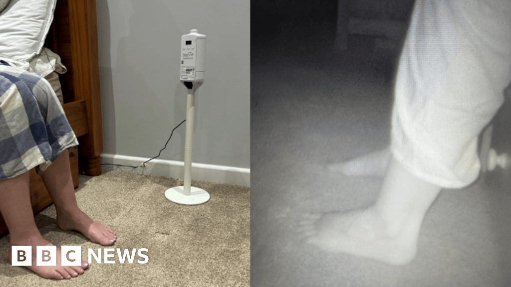 AI foot scanner could reduce heart failure hospitalisations