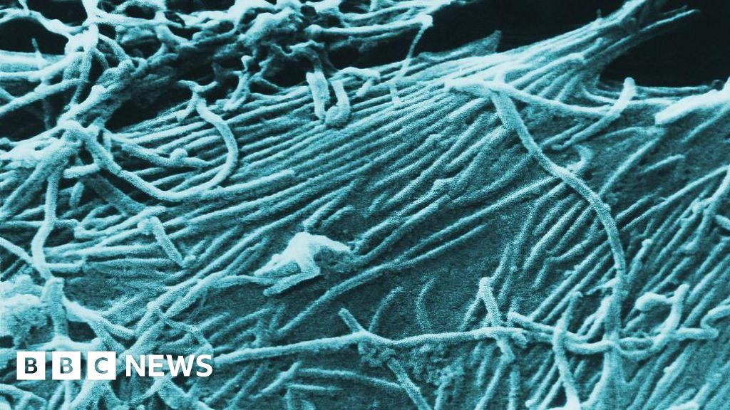 Ebola in Uganda: New outbreak kills nurse in Kampala