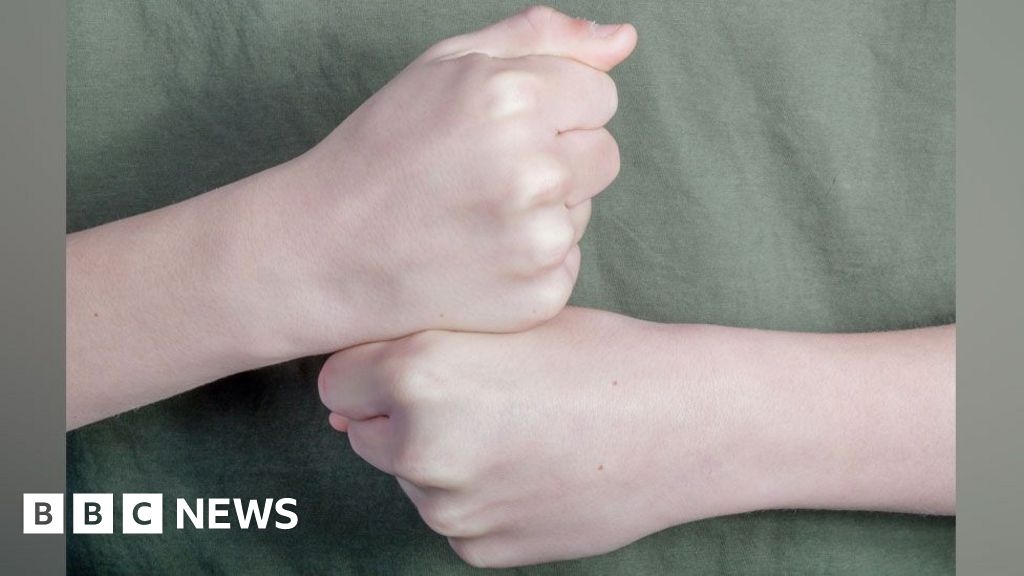 Story of sign-language educated West Harling pair 'remarkable'