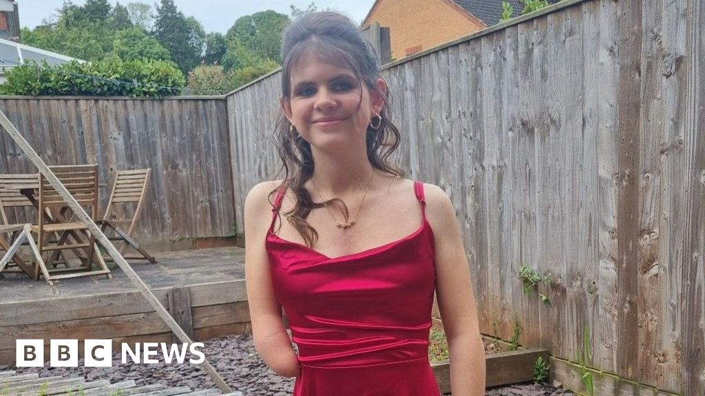 Somerset teenager wants a bionic arm to get into military