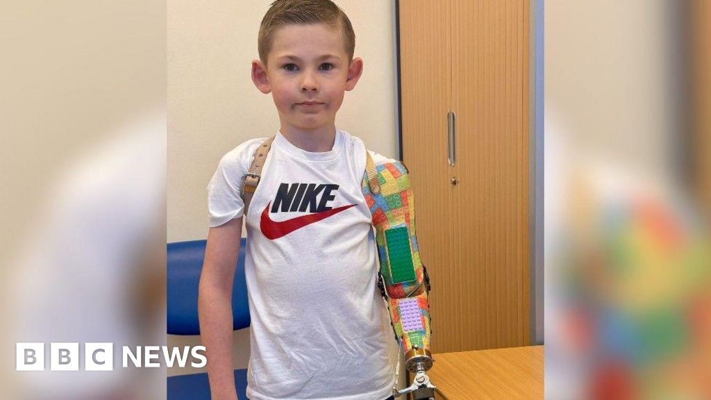 Portsmouth boy, 8, gets bespoke Lego prosthetic arm