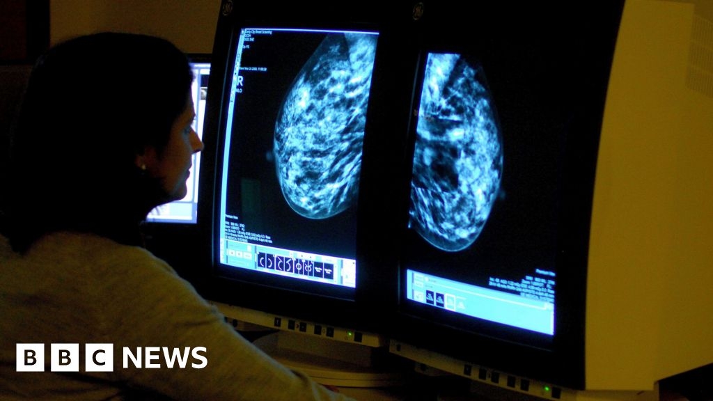 Isle of Man breast cancer clinic under 'enormous pressure'