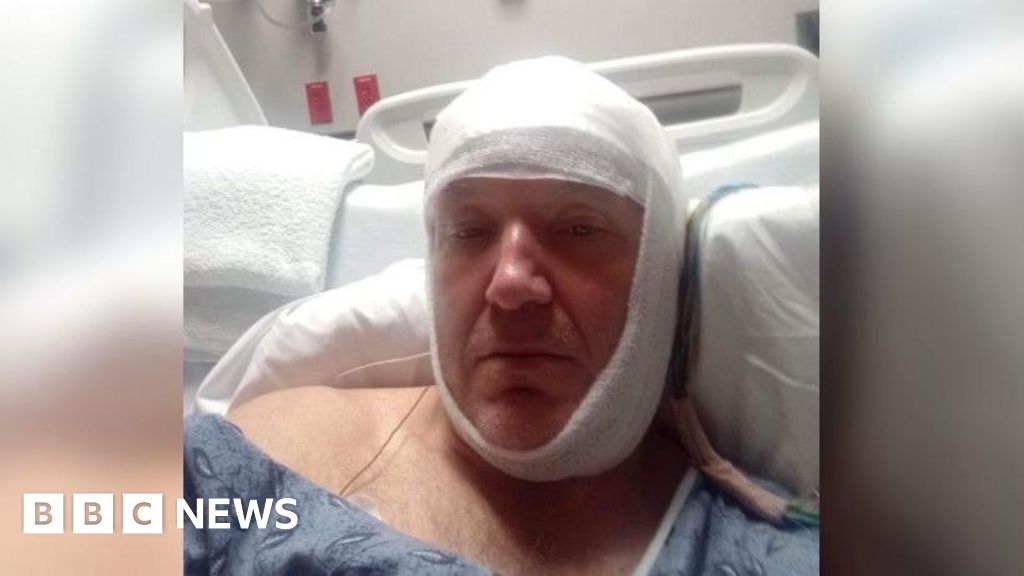 Derby man 'lucky to be alive' after US building site fall