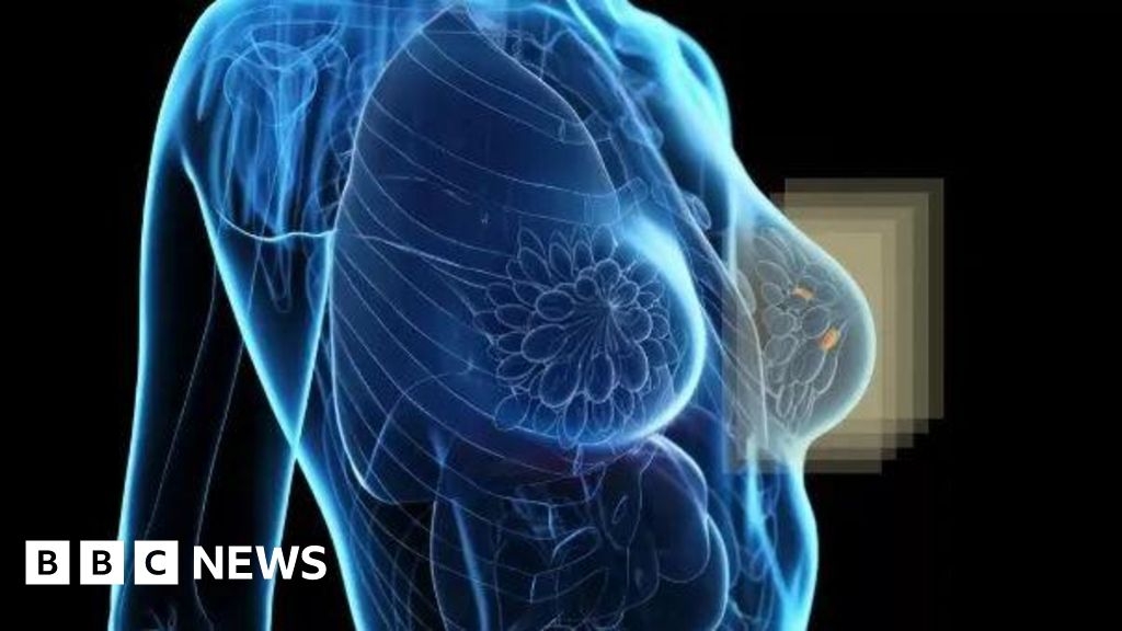 Prototype 'to light up' hidden breast cancers