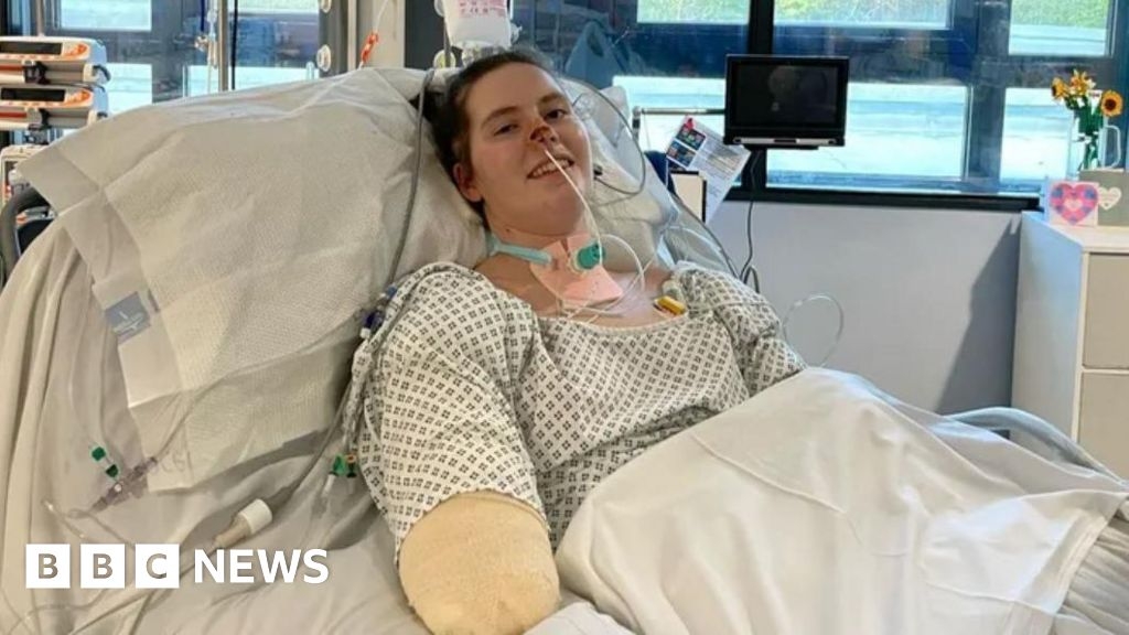 Jersey business to hold concert for sepsis amputee