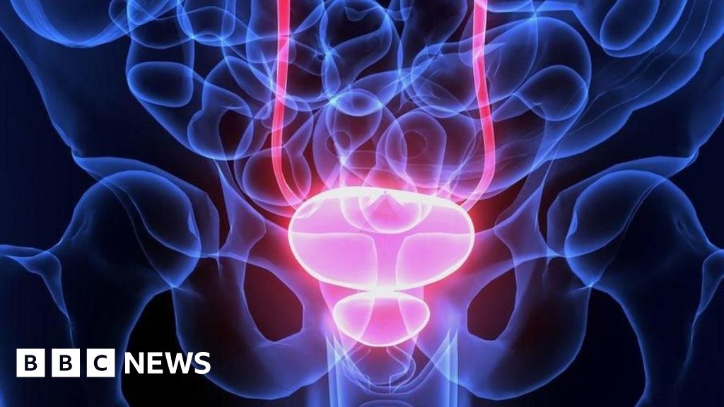 Men being over-treated for prostate cancer, says charity