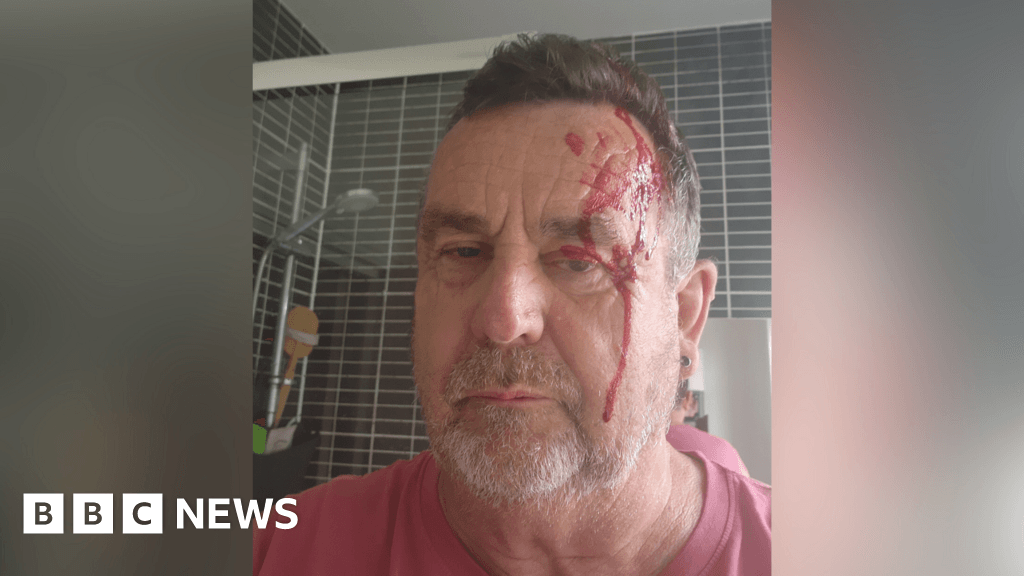Hastings man left bloodied after seagull attack near home