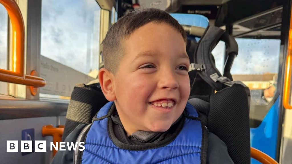Sheffield Children's Hospital epilepsy drug trial 'life-changing'