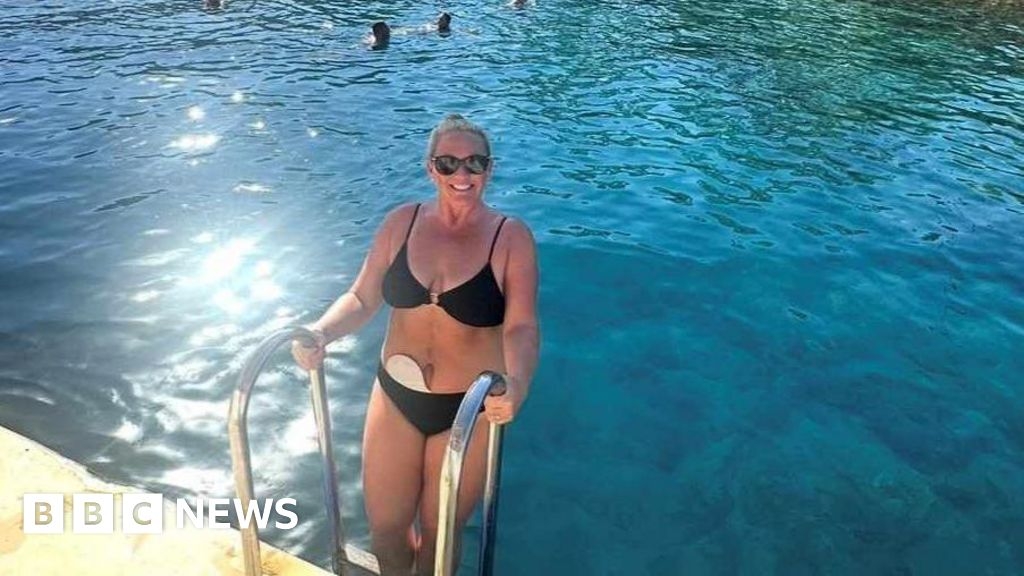 Hampshire colitis patient hopes to make fitness history
