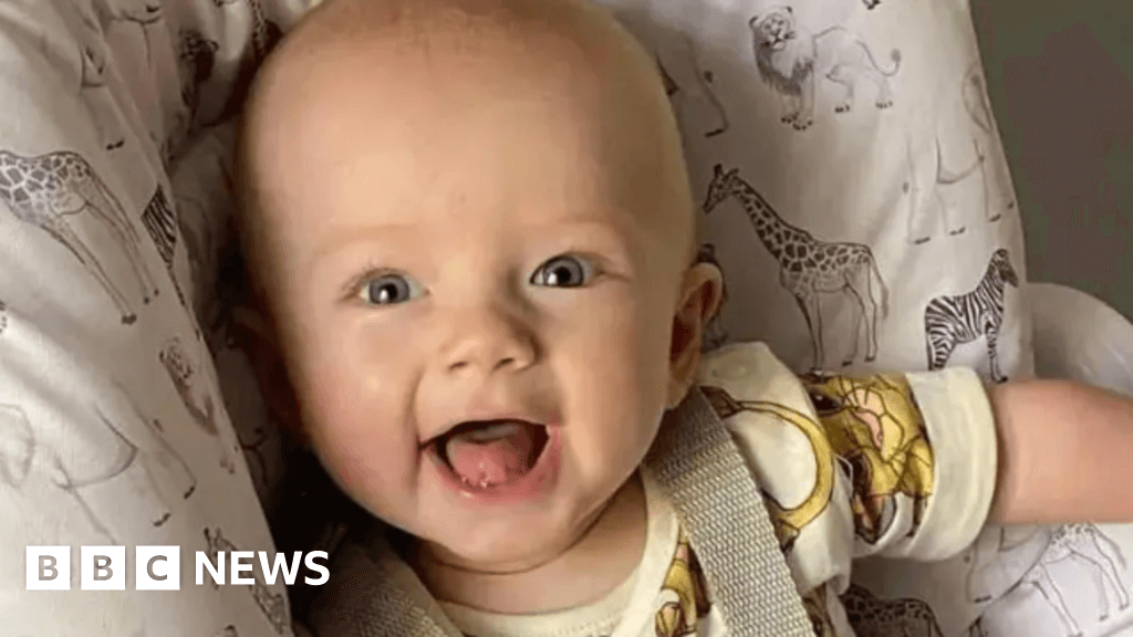 Baby Archie had 'incredibly rare' heart condition, expert says