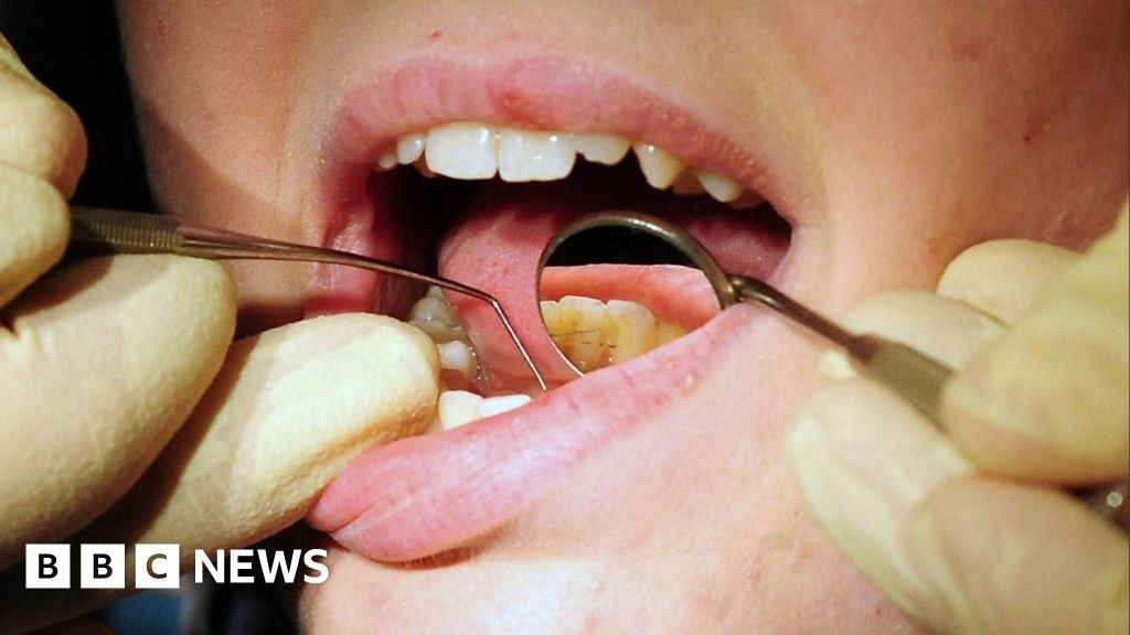 Manx children's oral health worse than UK, report finds