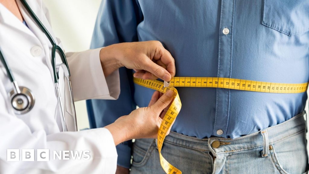 Northern Ireland to launch first obesity management service