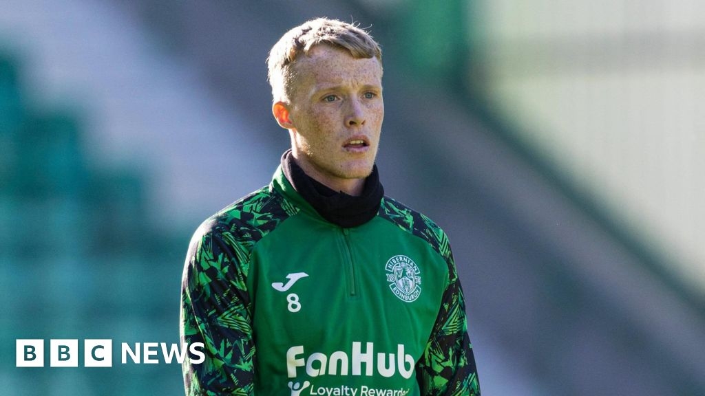 Former Hibs player sues club over training injury from manager