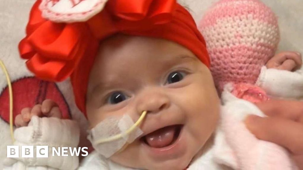 Newport: Baby with rare life-threating disorder finds donor
