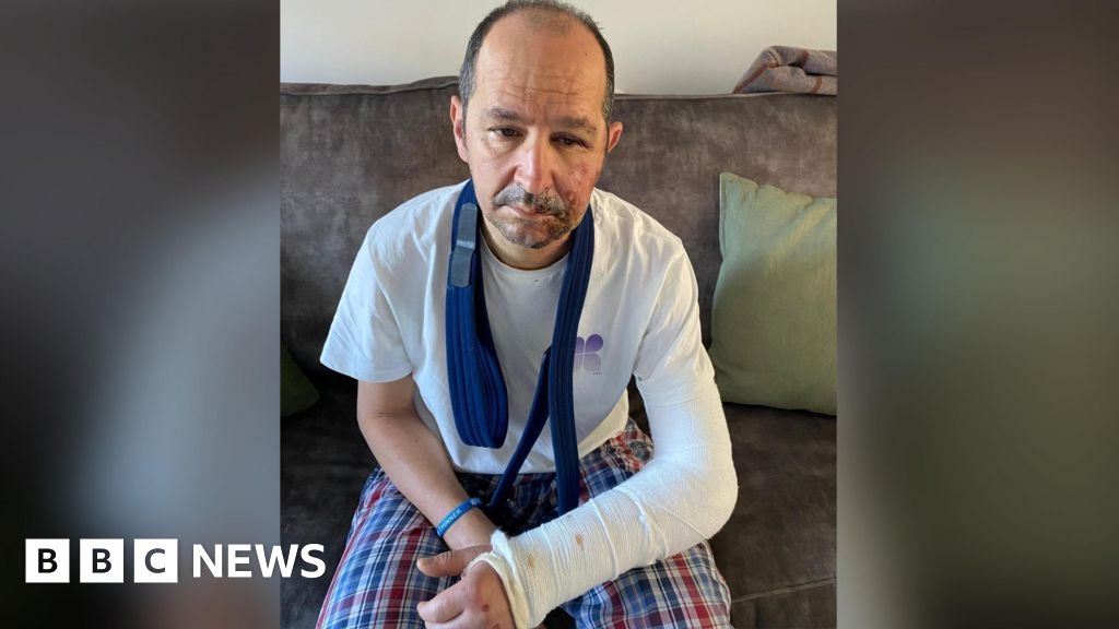 East Sussex cyclist breaks bones after pothole left unfilled