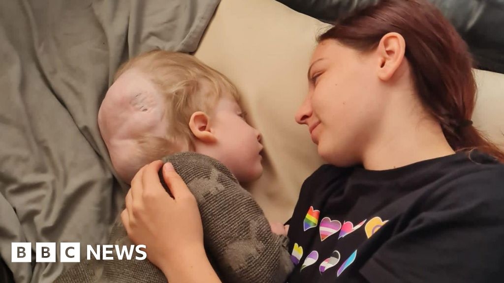 Bristol carer, 21, shares story of looking after little brother