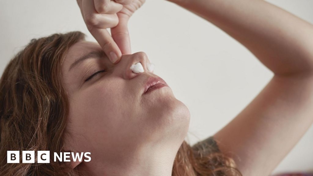Hull hospital introduces new treatment for severe nosebleeds