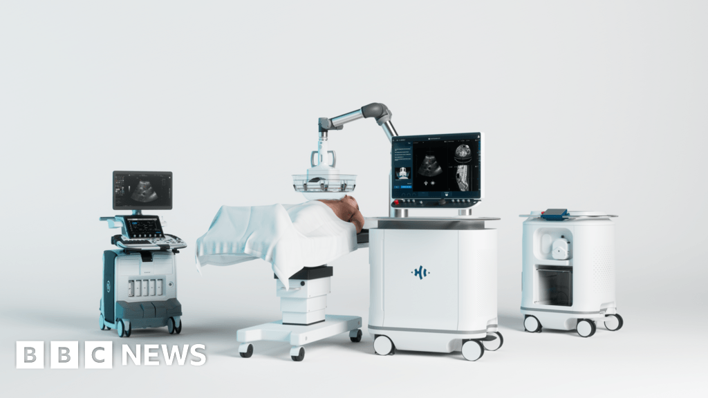 New ultrasound forecast to cut Addenbrooke's treatment times