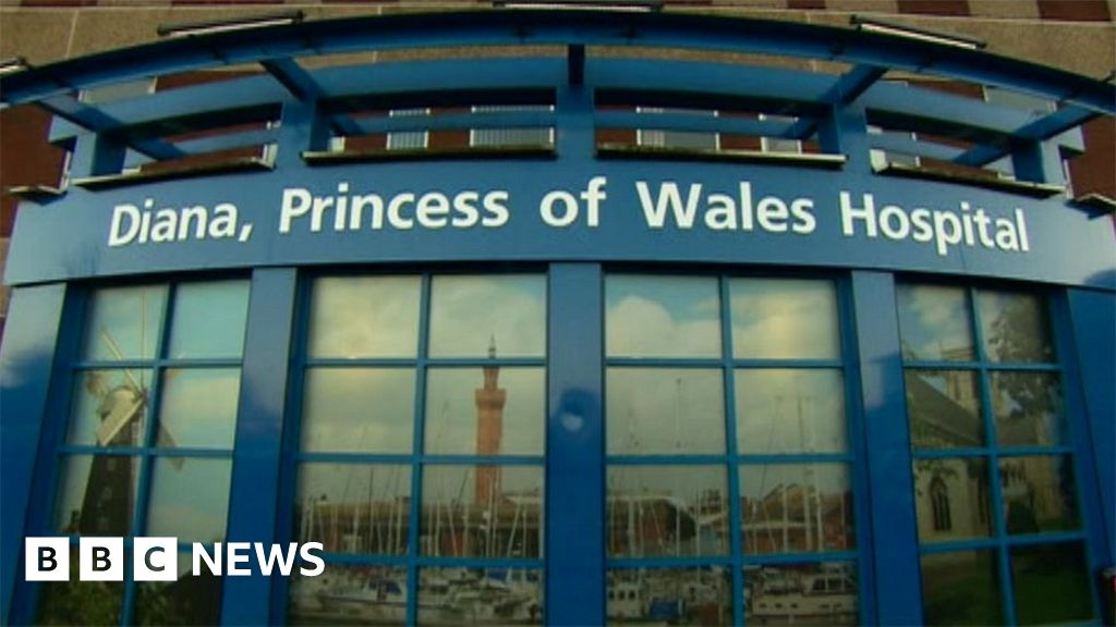 Grimsby to get two new high-tech bone scanning machines