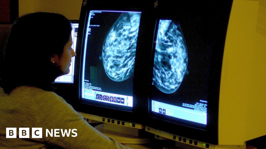 Charity to take part in Isle of Man breast screening review