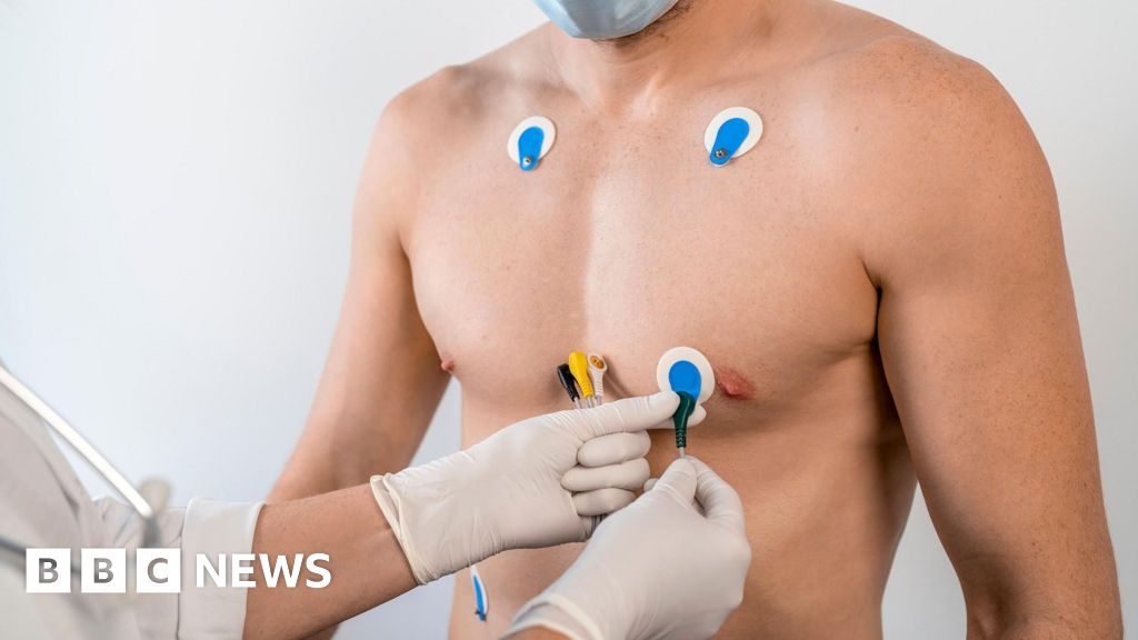 Suffolk doctor leads AI study into early tests for heart problems