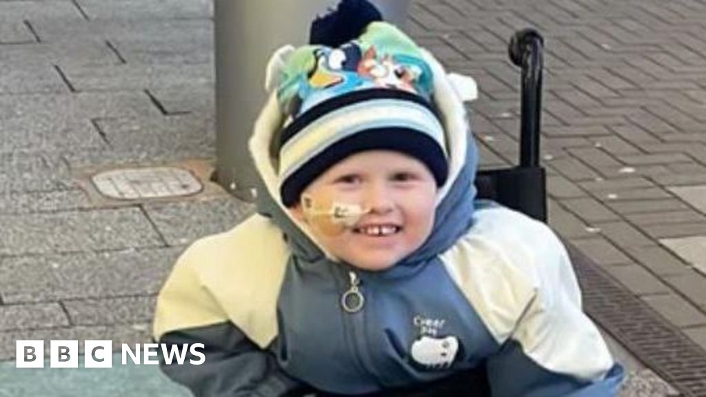Appeal to buy artificial legs for Coventry four-year-old
