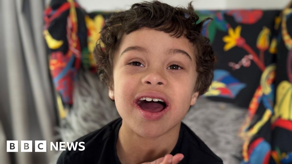 Bath child model with Down's syndrome selected by Burberry