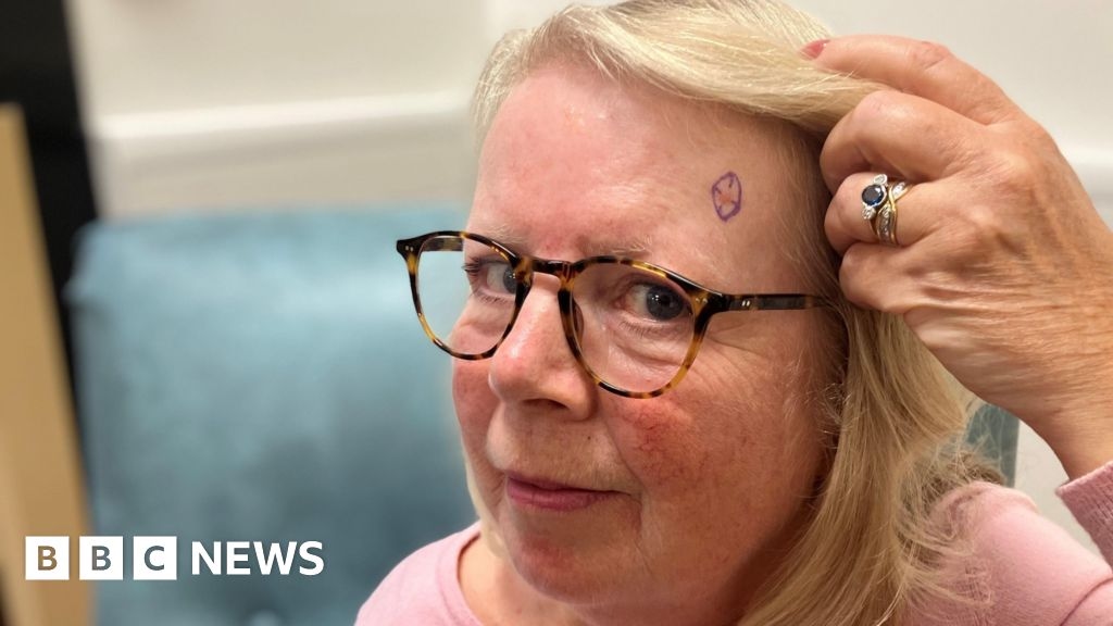 Digital imaging service slashes waits for skin cancer checks