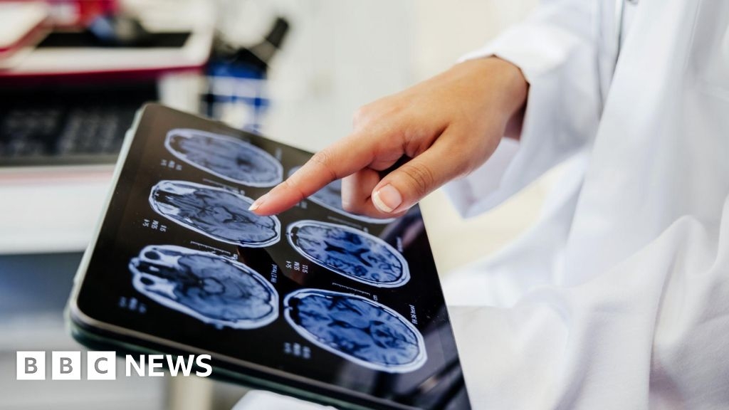 Cancer care 'time-bomb' warning over doctor shortages in Scotland