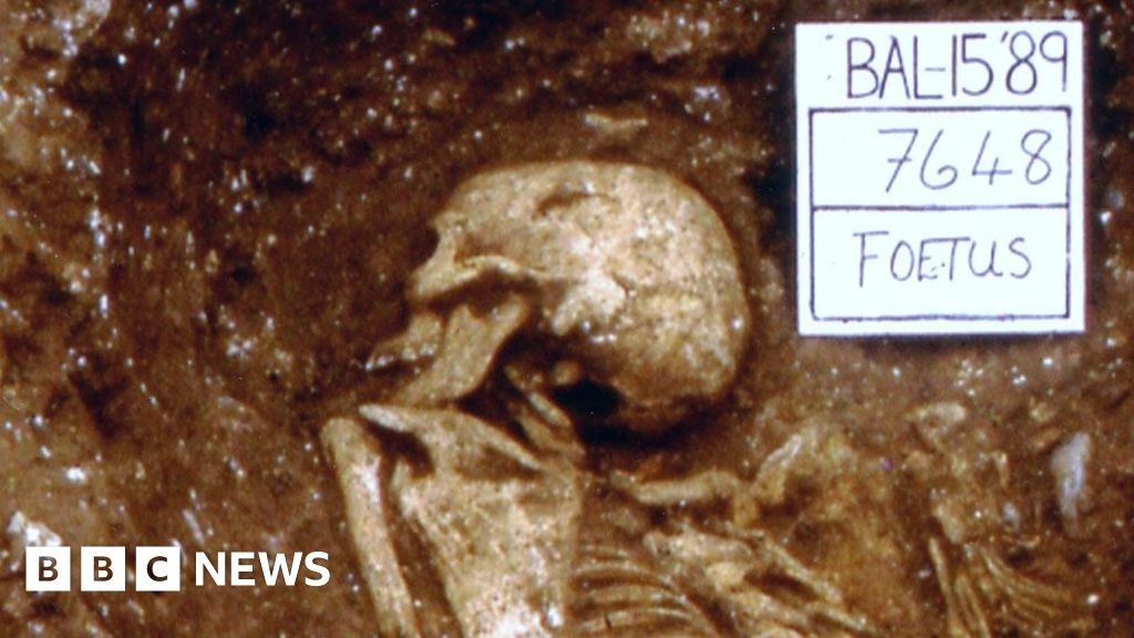 First known triplets are among Hertfordshire museums' treasures