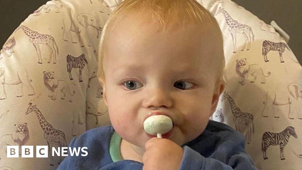 Baby Archie showed 'no signs of heart failure'