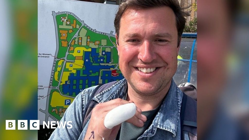 Exeter MP bitten by dog while delivering election leaflets