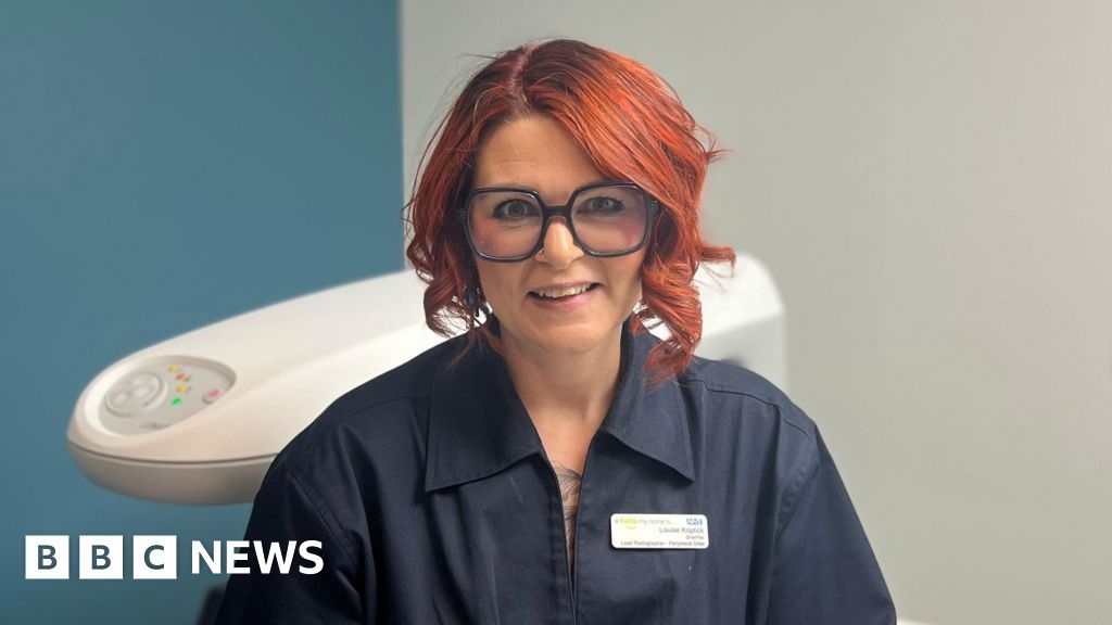 Otley and Leeds hospitals given bone density scanner boost