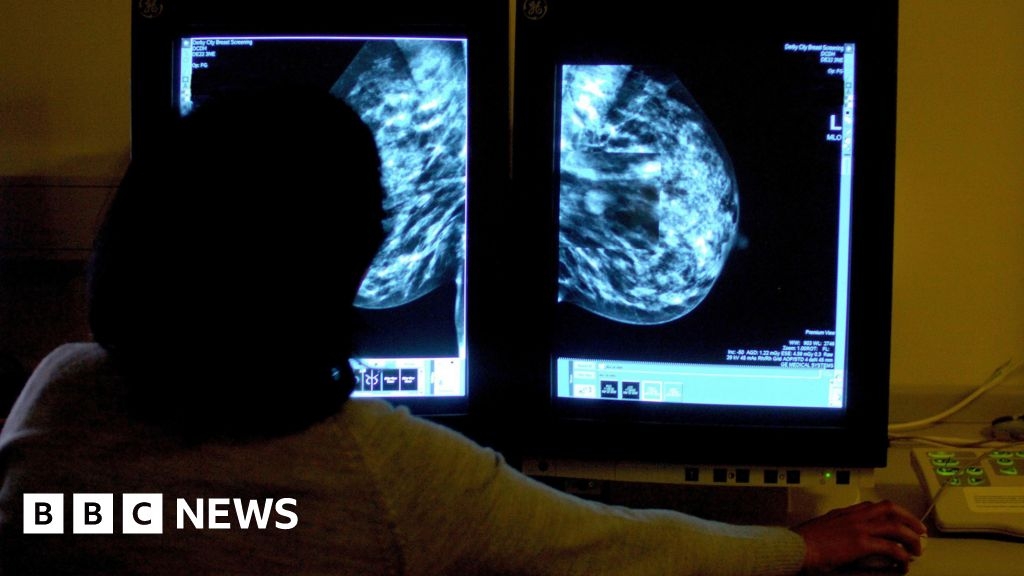 Isle of Man breast clinics resume after staffing issues