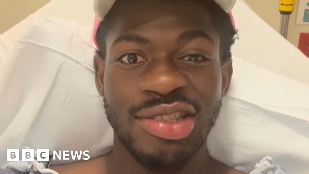 Lil Nas X in hospital with partial face paralysis
