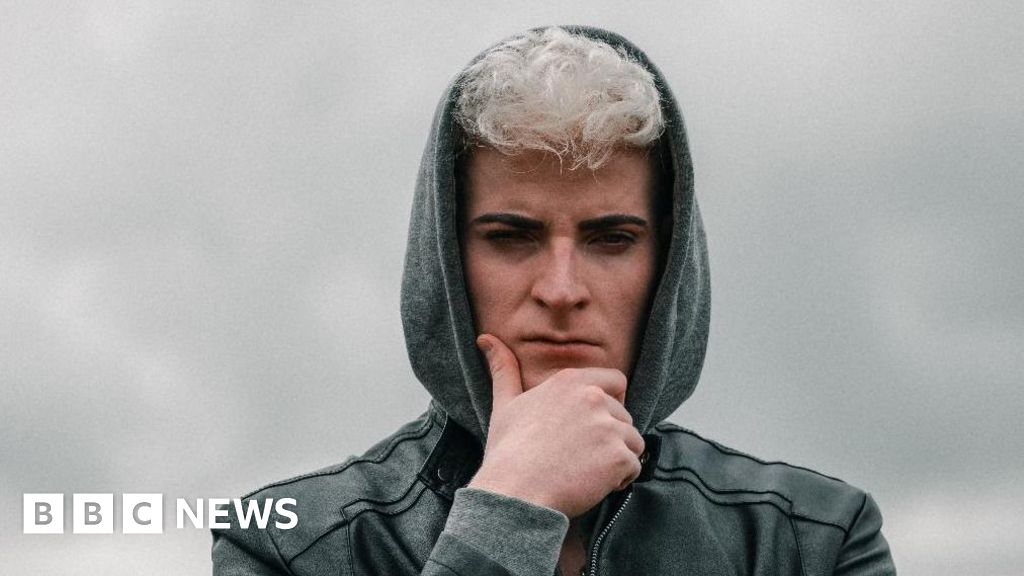 Albino hypnotist Fraser Penman: I hypnotised myself to become a headline act
