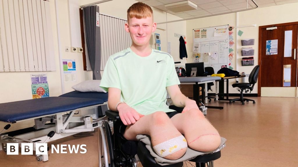 Teenager who lost his legs in crash will 'never forgive' driver