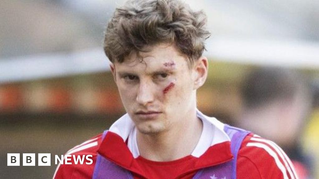 Man charged after footballer struck on head by seat at game