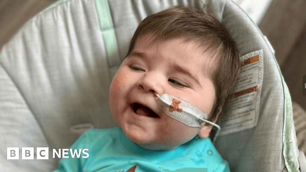PPFIBP1 gene: Parents' worldwide search for babies with son's rare condition
