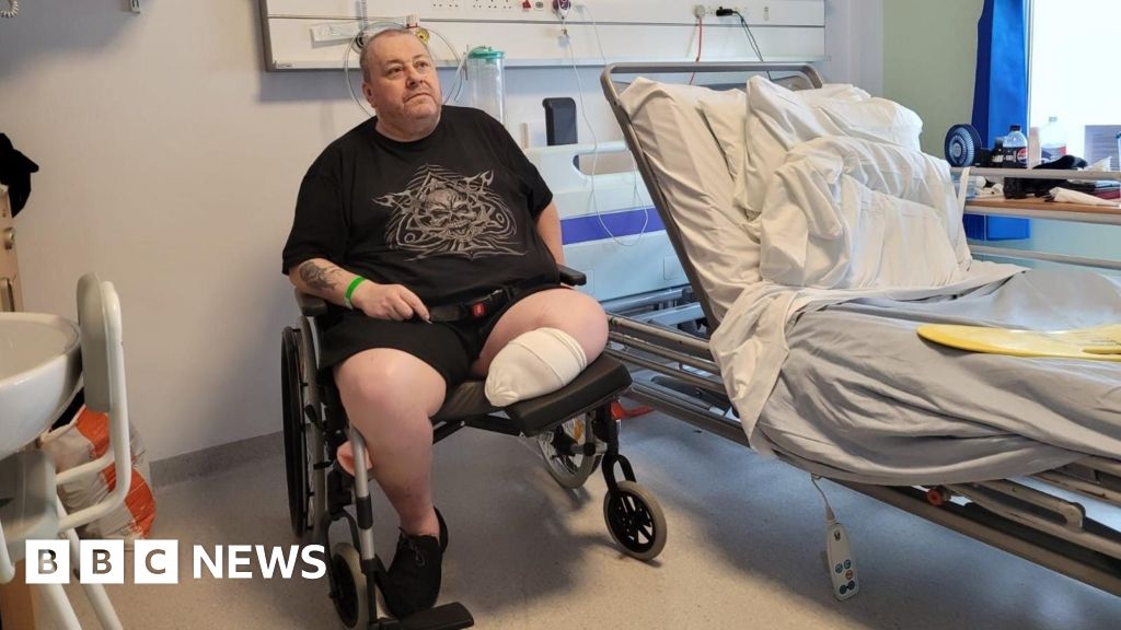 Patient 'stuck' in West Yorkshire hospital after leg amputation