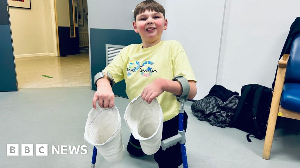 Double-amputee Tony Hudgell will be able to walk without crutches
