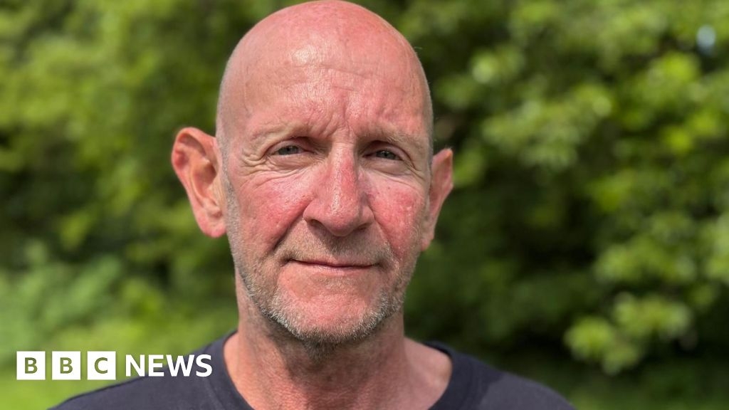 Alcohol-related brain damage could affect thousands, warns expert