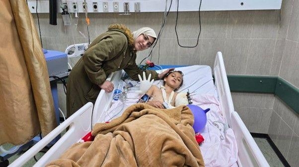 جراح عراقي يعيد وصل يد طفلة غزاوية بعد بترها وفقدانها تحت الركام